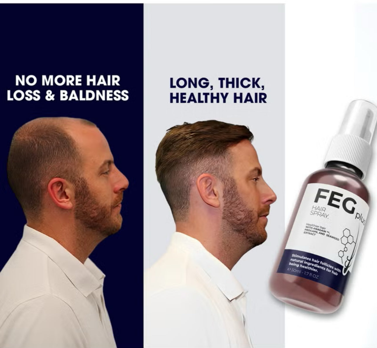 FEG Hair Growth Spray