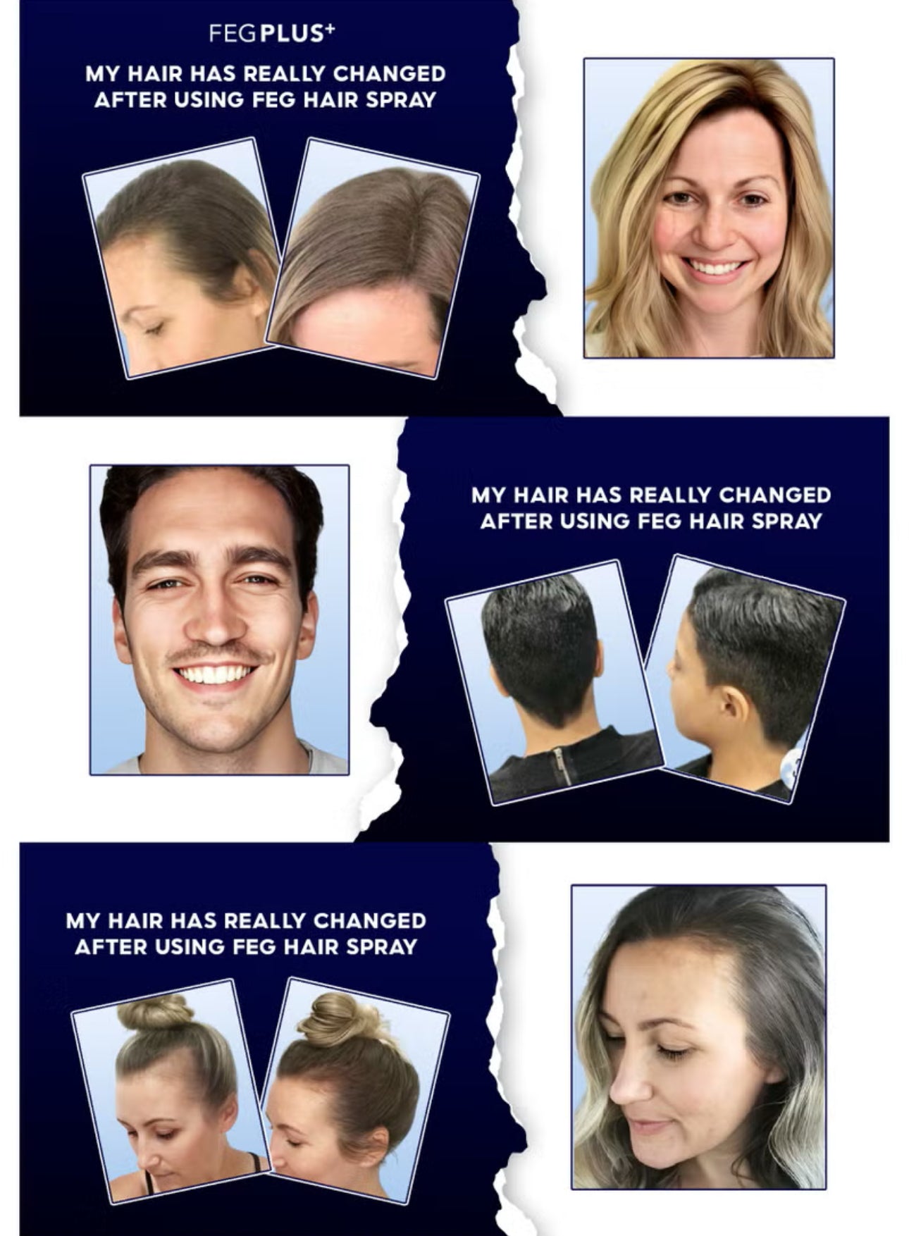 FEG Hair Growth Spray